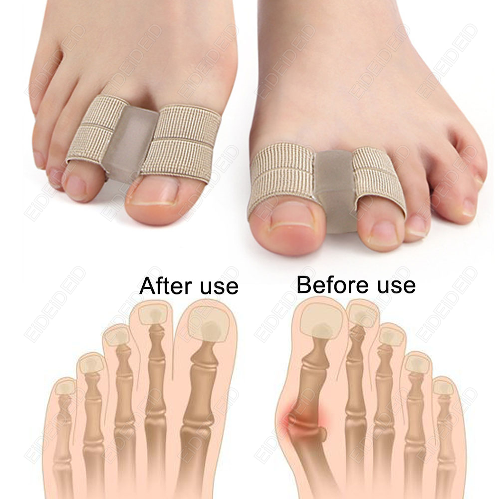 バニオンつま先コレクター矯正器具足の骨親指アジャスター外反母 - Women'S Shoes With Bunions のレビューと価格
